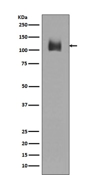 LAMP2a Rabbit Monoclonal Antibody