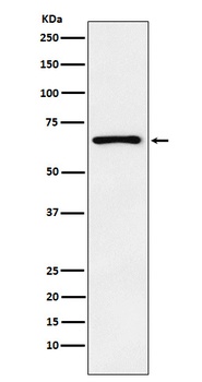 Parathyroid Hormone Receptor 1 Rabbit Monoclonal Antibody