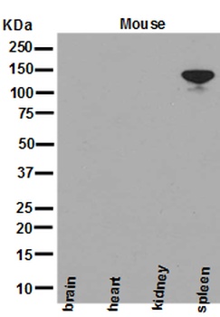 NEDD4-2 NEDD4L Rabbit Monoclonal Antibody