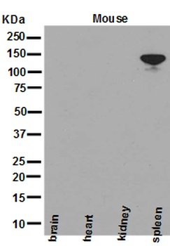 Anti-NEDD4-2 NEDD4L Rabbit Monoclonal Antibody