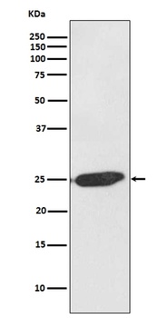 SNAP25 Rabbit Monoclonal Antibody