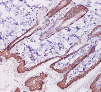 Cytokeratin 1 Rabbit Monoclonal Antibody