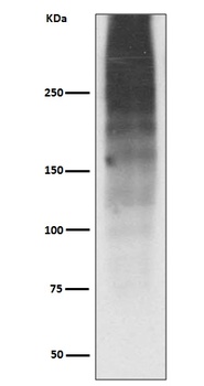 MUC16/Ca125 Rabbit Monoclonal Antibody