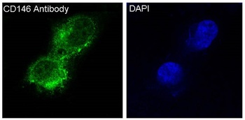 CD146 MCAM Rabbit Monoclonal Antibody