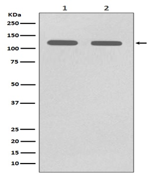 CD146 MCAM Rabbit Monoclonal Antibody