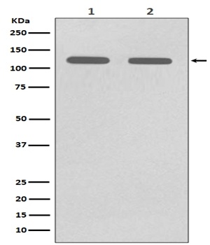 Anti-CD146 MCAM Rabbit Monoclonal Antibody