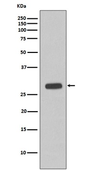 Troponin I Rabbit Monoclonal Antibody