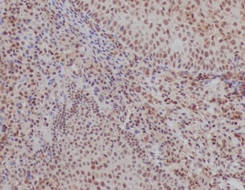 Ku70 XRCC6 Rabbit Monoclonal Antibody