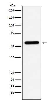 Liver Carboxylesterase 1 Rabbit Monoclonal Antibody