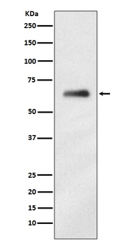 hnRNP K Rabbit Monoclonal Antibody
