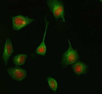 Anti-HDAC8/Histone Deacetylase 8 Rabbit Monoclonal Antibody