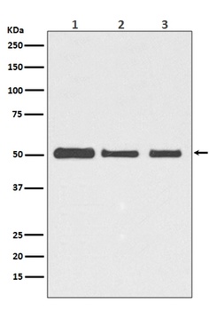 beta III Tubulin TUBB3 Rabbit Monoclonal Antibody