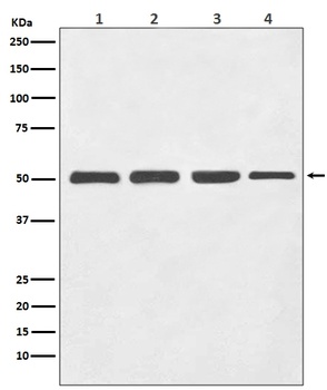 beta III Tubulin TUBB3 Rabbit Monoclonal Antibody