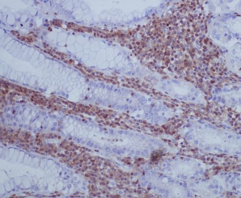 GAP43 Rabbit Monoclonal Antibody