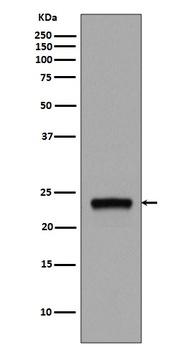 Anti-Rab5 RAB5A Rabbit Monoclonal Antibody