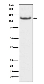 HDAC7/Histone Deacetylase 7 Rabbit Monoclonal Antibody