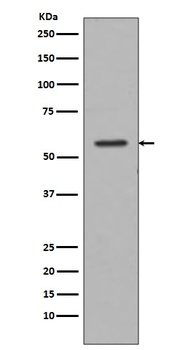 Anti-Tyrosine Hydroxylase TH Rabbit Monoclonal Antibody