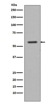 Tyrosine Hydroxylase TH Rabbit Monoclonal Antibody