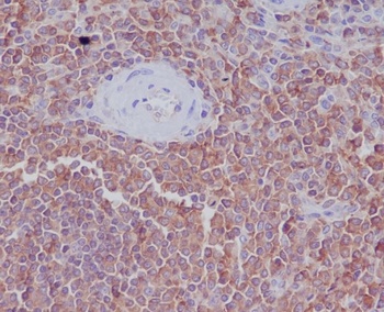 Radixin Rabbit Monoclonal Antibody