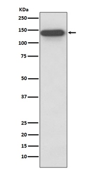 SMC3 Rabbit Monoclonal Antibody
