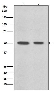 Anti-Desmin Rabbit Monoclonal Antibody