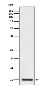 S100P Rabbit Monoclonal Antibody