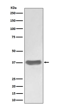 SFRP1 Rabbit Monoclonal Antibody