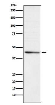 RRM2 Rabbit Monoclonal Antibody