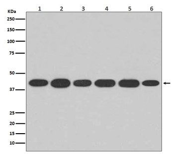 Anti-Actin ACTA1 Rabbit Monoclonal Antibody
