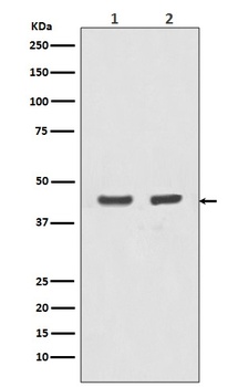 Anti-Actin (Alpha-Actin) ACTA1 Rabbit Monoclonal Antibody