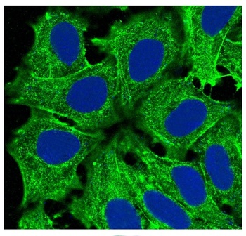 Anti-Actin (Alpha-Actin) ACTA1 Rabbit Monoclonal Antibody