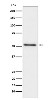 Prostatic Acid Phosphatase ACPP Monoclonal Antibody