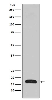 p16 ARC ARPC5 Rabbit Monoclonal Antibody