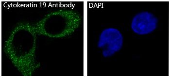 Cytokeratin 19 KRT19 Rabbit Monoclonal Antibody