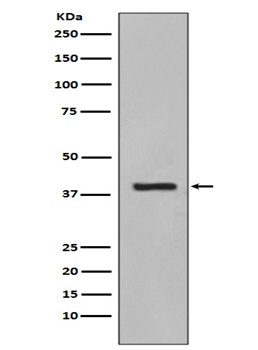 Cytokeratin 19 KRT19 Rabbit Monoclonal Antibody