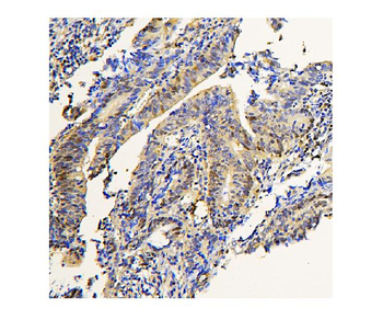 Anti-ADK Antibody (monoclonal, 7F4)