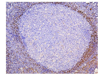 Anti-ADK Antibody (monoclonal, 7F4)
