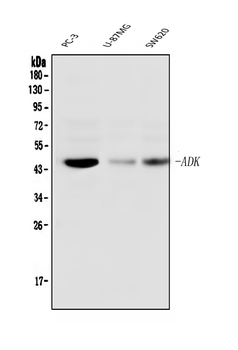 Anti-ADK Antibody (monoclonal, 7F4)