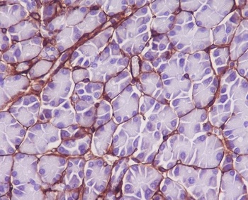 Collagen VI COL6A1 Rabbit Monoclonal Antibody