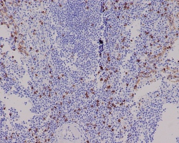 CD8 alpha Rabbit Monoclonal Antibody