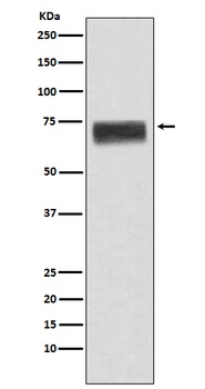 Hemopexin HPX Rabbit Monoclonal Antibody