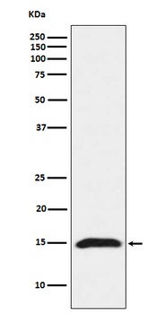 Fragilis IFITM3 Rabbit Monoclonal Antibody