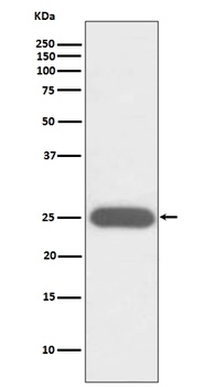 G-CSF CSF3/CSF Rabbit Monoclonal Antibody
