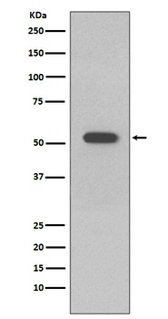 Cytokeratin 10 KRT10 Rabbit Monoclonal Antibody