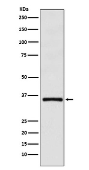 DMRT1 Rabbit Monoclonal Antibody