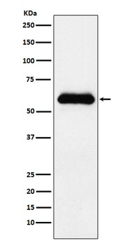 alpha 1 Antichymotrypsin SERPINA3 Rabbit Monoclonal Antibody