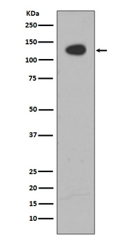 ATP citrate lyase ACLY Rabbit Monoclonal Antibody