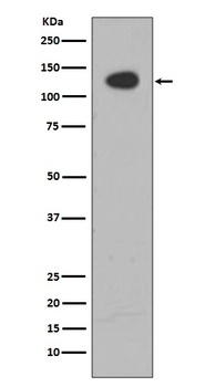Anti-ATP citrate lyase ACLY Rabbit Monoclonal Antibody