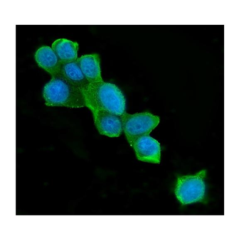 Anti-ATP citrate lyase ACLY Antibody (monoclonal, 5I2)