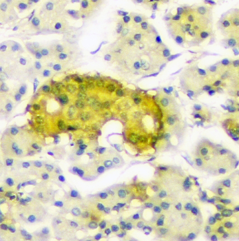Anti-ATP citrate lyase ACLY Antibody (monoclonal, 5I2)